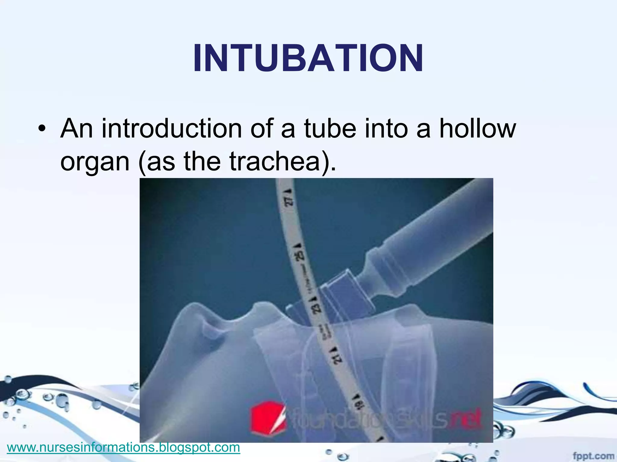 INTUBATION
    • An introduction of a tube into a hollow
      organ (as the trachea).




www.nursesinformations.blogspot.com
 