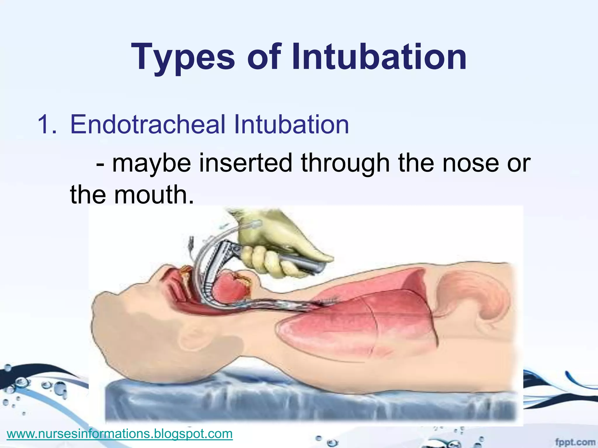 Types of Intubation
    1. Endotracheal Intubation
         - maybe inserted through the nose or
       the mouth.




www.nursesinformations.blogspot.com
 