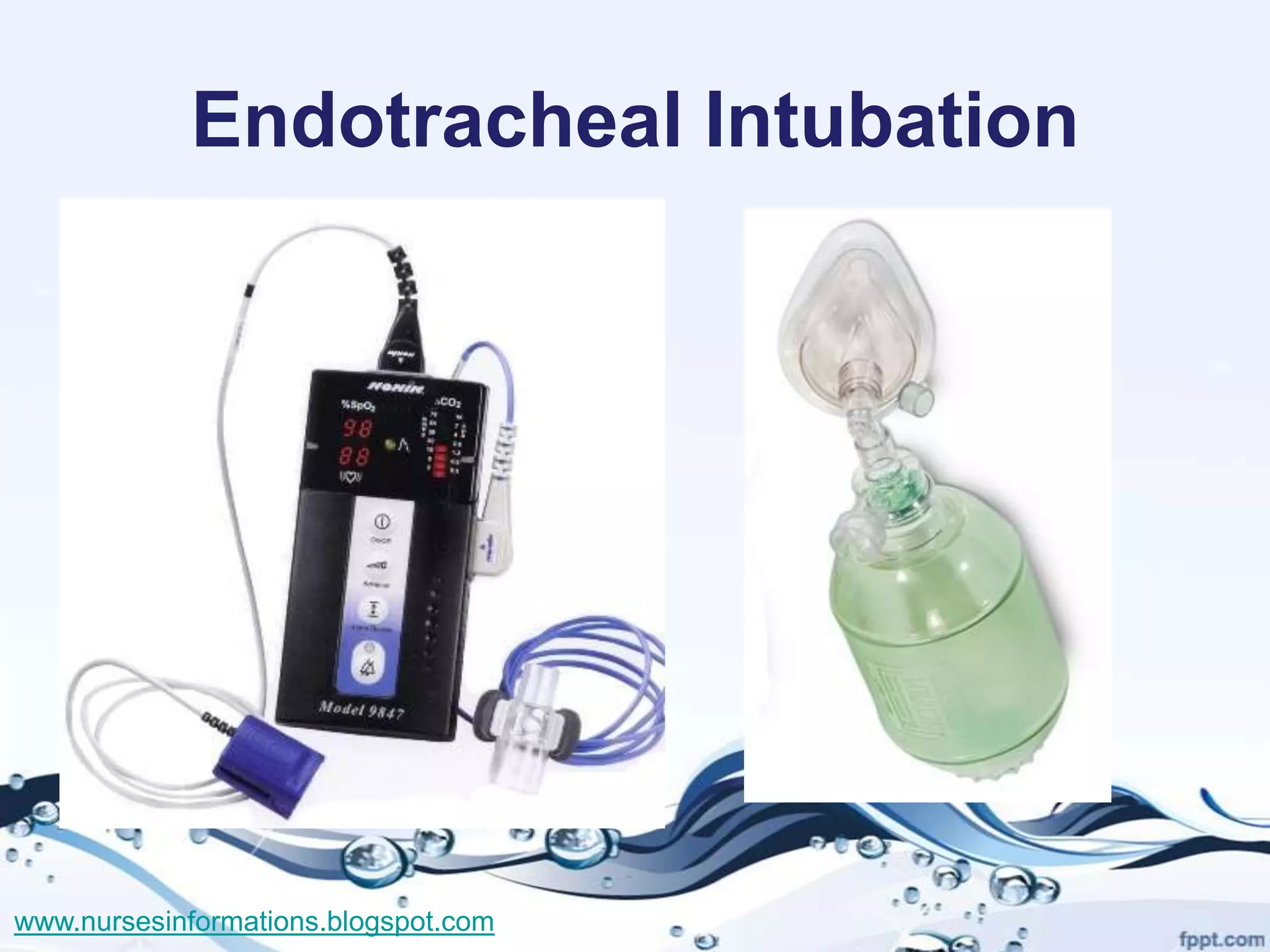 Endotracheal Intubation




www.nursesinformations.blogspot.com
 