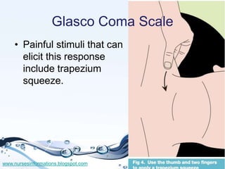 Glasco Coma Scale
    • Painful stimuli that can
      elicit this response
      include trapezium
      squeeze.




www...