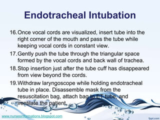 Endotracheal Intubation
    16.Once vocal cords are visualized, insert tube into the
       right corner of the mouth and ...