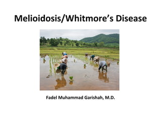 Melioidosis/Whitmore’s	Disease		
Fadel	Muhammad	Garishah,	M.D.	
 