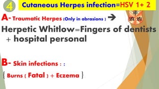 ID2-MB-6-Herpes 1,2,3.pdf