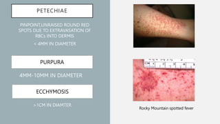 Dermatology. Basic skin leisons ( primary and secondary)pptx | PPTX