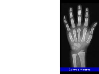 2 anos e  8 meses 