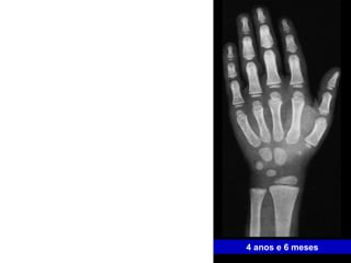 4 anos e 6 meses 