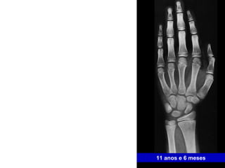 11 anos e 6 meses 