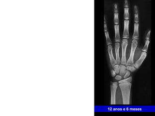 12 anos e 6 meses 