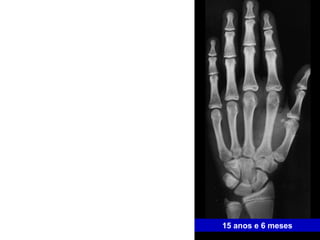 15 anos e 6 meses 