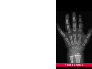 1 ano e 6 meses 