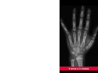 4 anos e 2 meses 