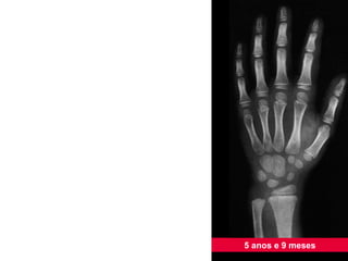 5 anos e 9 meses 