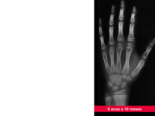 6 anos e 10 meses 