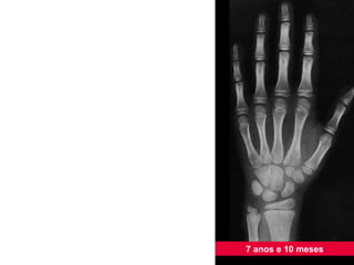 7 anos e 10 meses 
