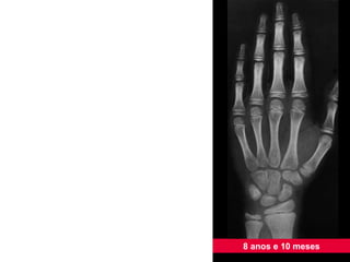 8 anos e 10 meses 
