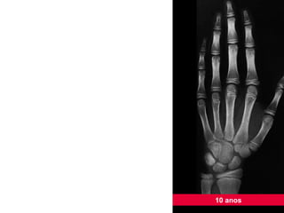 10 anos 