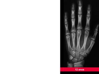 12 anos 