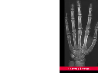 13 anos e 6 meses 