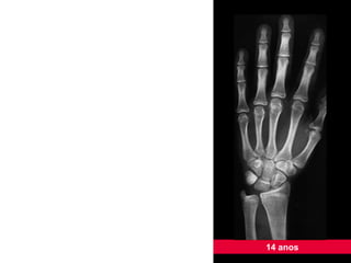14 anos 