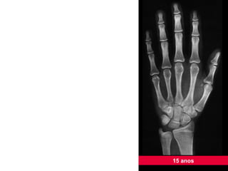 15 anos 