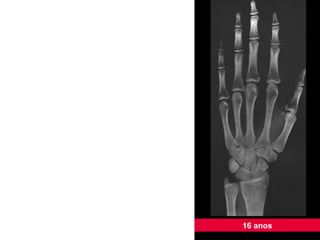 16 anos 