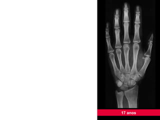 17 anos 