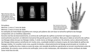 Pré-púbere
Meninas: 2 anos a 7 anos de idade
Meninos: 3 anos a 9 anos de idade
As avaliações da maturidade esquelética em crianças pré-púberes são com base no tamanho epifisário das falanges
comparando com as metafíses adjacentes.
Durante esta fase de desenvolvimento, os centros de ossificação dss epífises aumentam em largura e espessura, e
eventualmente assumem um diâmetro transversal tão grande quanto as metáfises. Mais peso é dado ao tamanho das epífises
nas falanges distais do que nas falanges médias. E ainda menos às falanges proximais. No entanto, como o desenvolvimento
das falanges distais parece semelhante em muitos anos, a avaliação também se baseia no grau de maturidade da epífises das
falanges médias. Em ocasiões muito raras, quando há dúvida, o desenvolvimento da falange proximal pode ser incluído na
avaliação. A epífise da ulna e todos os ossos do carpo, com exceção do pisiforme, geralmente se tornam reconhecíveis antes da
puberdade. No entanto, esses centros de ossificação, como os dos metacarpos, são indicadores menos confiáveis da idade
óssea nesta fase da vida.
 