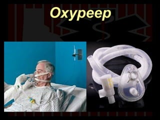 Oxypeep 