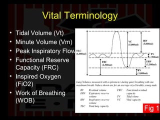 Vital Terminology Tidal Volume (Vt) Minute Volume (Vm) Peak Inspiratory Flow Functional Reserve Capacity (FRC) Inspired Oxygen (FiO2) Work of Breathing (WOB) 