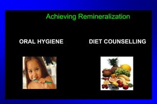 Achieving Remineralization
ORAL HYGIENE DIET COUNSELLING
 