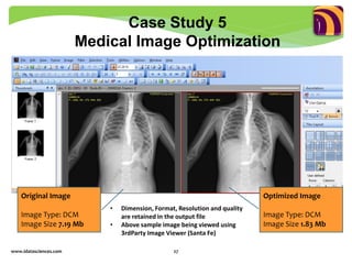 www.idatasciences.com 27
Case Study 5
Medical Image Optimization
• Dimension, Format, Resolution and quality
are retained in the output file
• Above sample image being viewed using
3rdParty Image Viewer (Santa Fe)
Original Image
Image Type: DCM
Image Size 7.19 Mb
Optimized Image
Image Type: DCM
Image Size 1.83 Mb
 