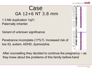 Case
GA 12+6 NT 3.8 mm
1.3 Mb duplication 1q21.
Paternally inheritet
Variant of unknown significance
Penetrance incomplete (17%?). Increased risk of
low IQ, autism, ADHD, dysmorphia.
After counselling they decided to continue the pregnancy – as
they knew about the problems of this family before-hand
!