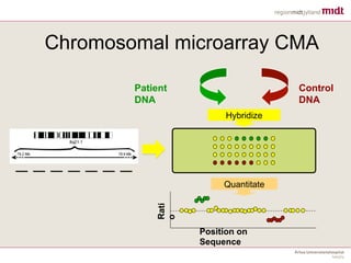 Chromosomal microarray CMA
Patient
DNA
Control
DNA
Rati
o
Position on
Sequence
Hybridize
Quantitate