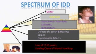 Goiter
Loss of 13 IQ points,
Leading Cause of Mental handicap
Cretinism
Spontaneous Abortions,
Stillbirths,
Birth Defects
Defects of Speech & Hearing,
Squint,
Psychomotor defects
 