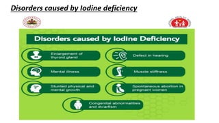 Disorders caused by Iodine deficiency
 