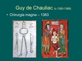 Guy de Chauliac (c.1300-1368)
• Chirurgia magna – 1363
 
