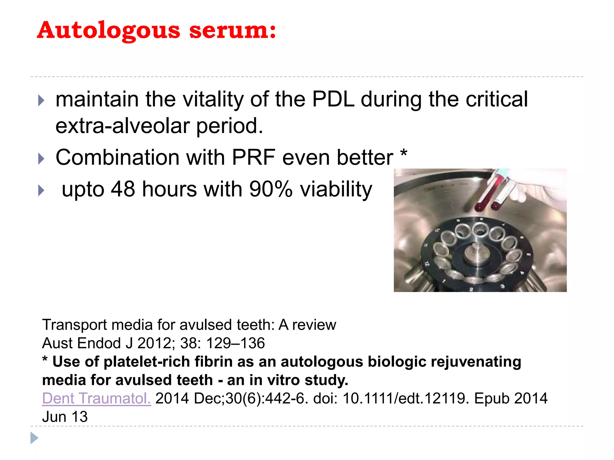 Autologous serum:
 maintain the vitality of the PDL during the critical
extra-alveolar period.
 Combination with PRF even better *
 upto 48 hours with 90% viability
Transport media for avulsed teeth: A review
Aust Endod J 2012; 38: 129–136
* Use of platelet-rich fibrin as an autologous biologic rejuvenating
media for avulsed teeth - an in vitro study.
Dent Traumatol. 2014 Dec;30(6):442-6. doi: 10.1111/edt.12119. Epub 2014
Jun 13
 
