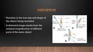 Size Distortion Radiograph ideal radiograph.pptx oral RADIOLOGY revision | PPTX