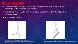Ideal radiographs in oral medicine and radiology | PDF