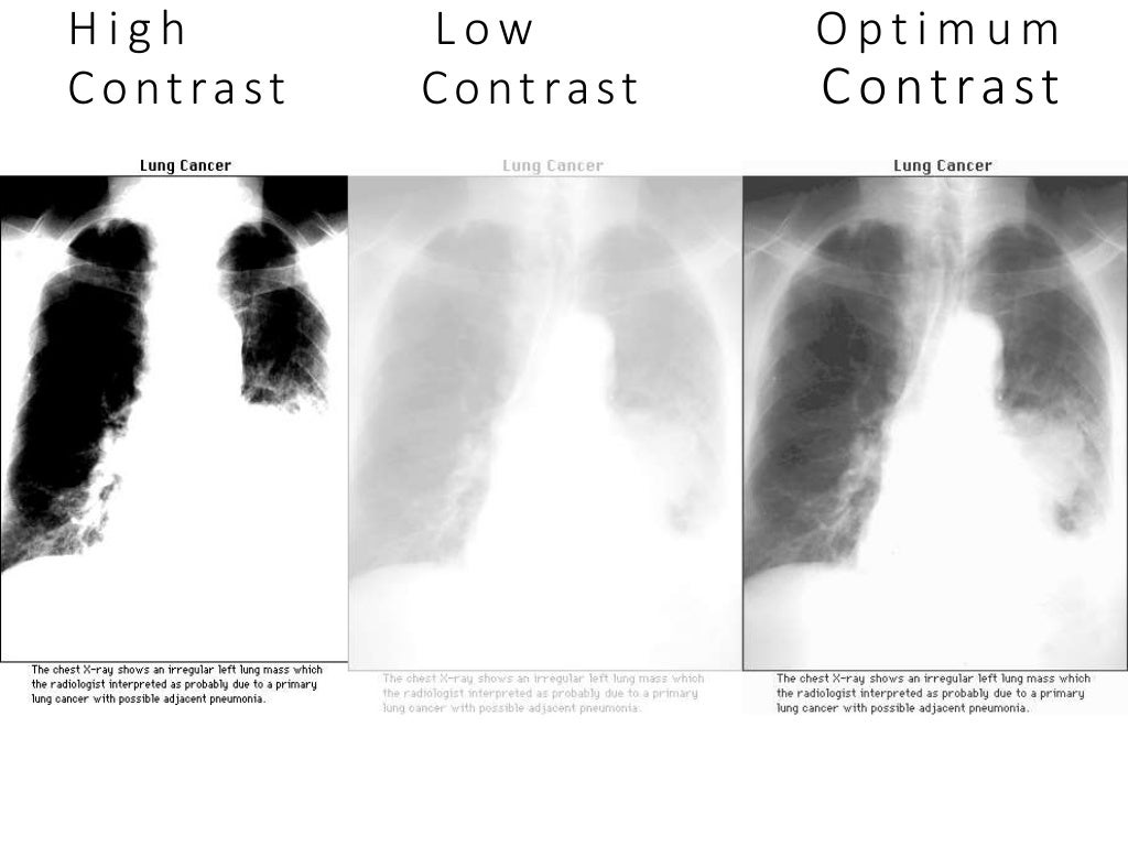 Ideal radiography