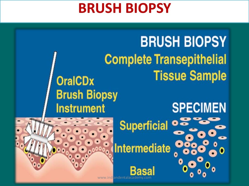 DIAGNOSTIC AIDS FOR ORAL CANCER/ dental crown & bridge courses