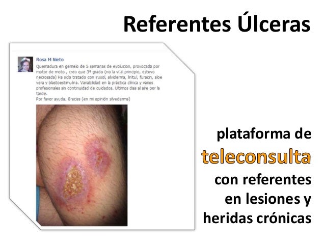 Al niño la fuerte eccema sobre la persona