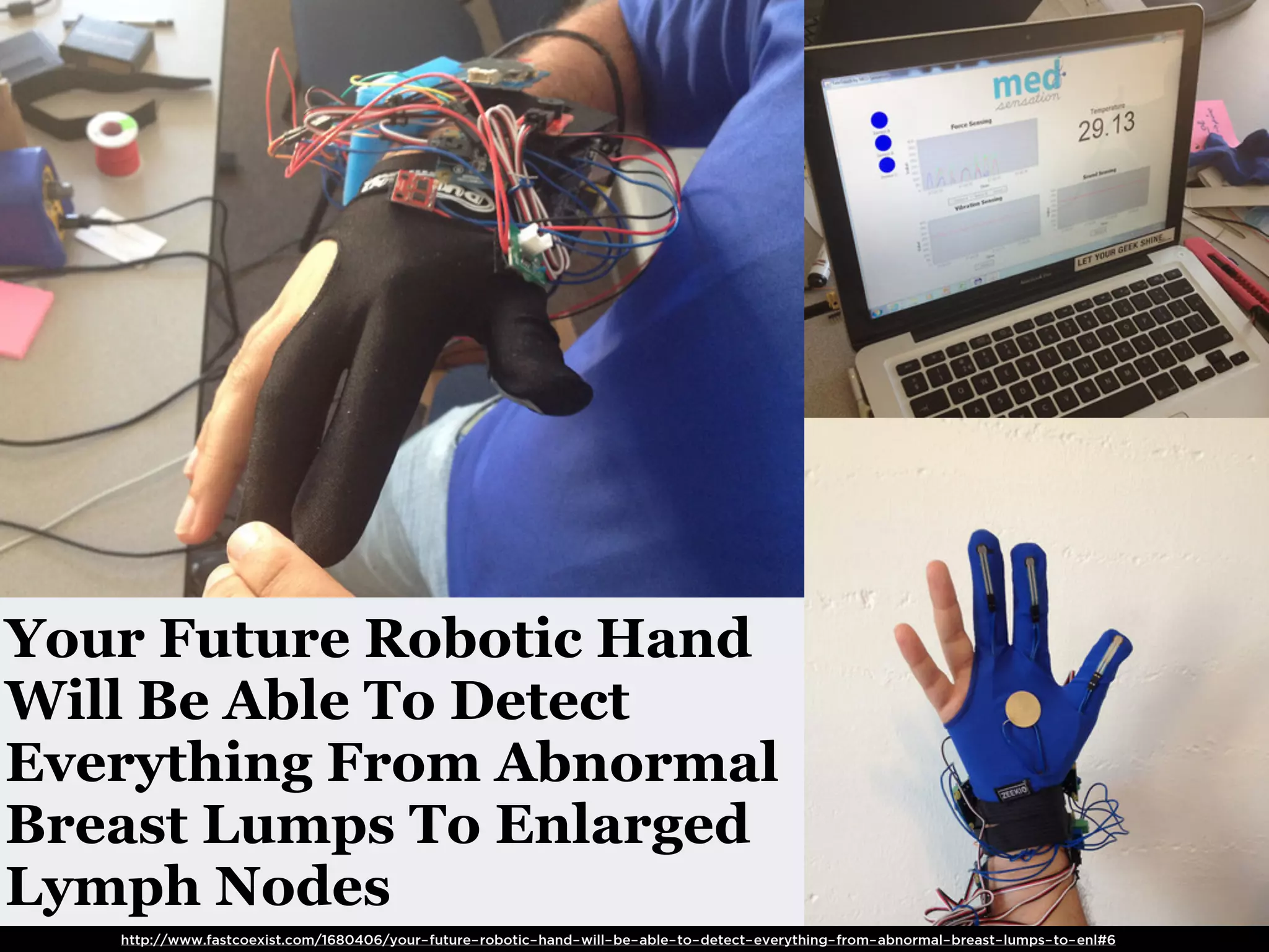 Your Future Robotic Hand
Will Be Able To Detect
Everything From Abnormal
Breast Lumps To Enlarged
Lymph Nodes
   http://www.fastcoexist.com/1680406/your-future-robotic-hand-will-be-able-to-detect-everything-from-abnormal-breast-lumps-to-enl#6
 