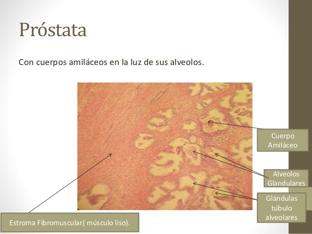 Identificación de estructuras histológicas(próstata y endometrio/plac…