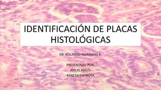 IDENTIFICACIÓN DE PLACAS
HISTOLÓGICAS
DR. ROLANDO ALVARADO A.
PRESENTADO POR:
JERLYS AVILÉS
KENETH ESPINOSA
 