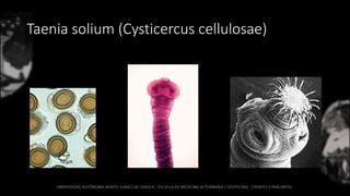 Taenia solium (Cysticercus cellulosae)
 