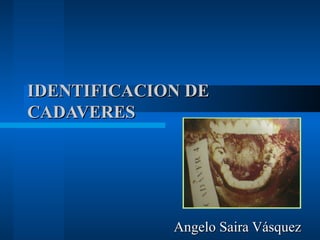 IDENTIFICACION DE CADAVERES Angelo Saira Vásquez 