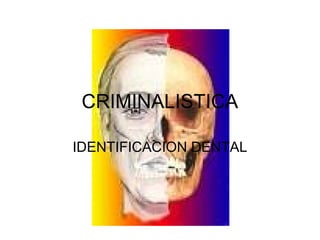 CRIMINALISTICA 
IDENTIFICACION DENTAL 
 