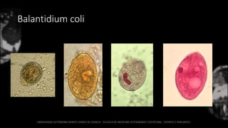 Balantidium coli
 