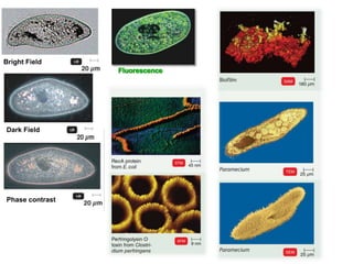 Bright Field
Dark Field
Phase contrast
 